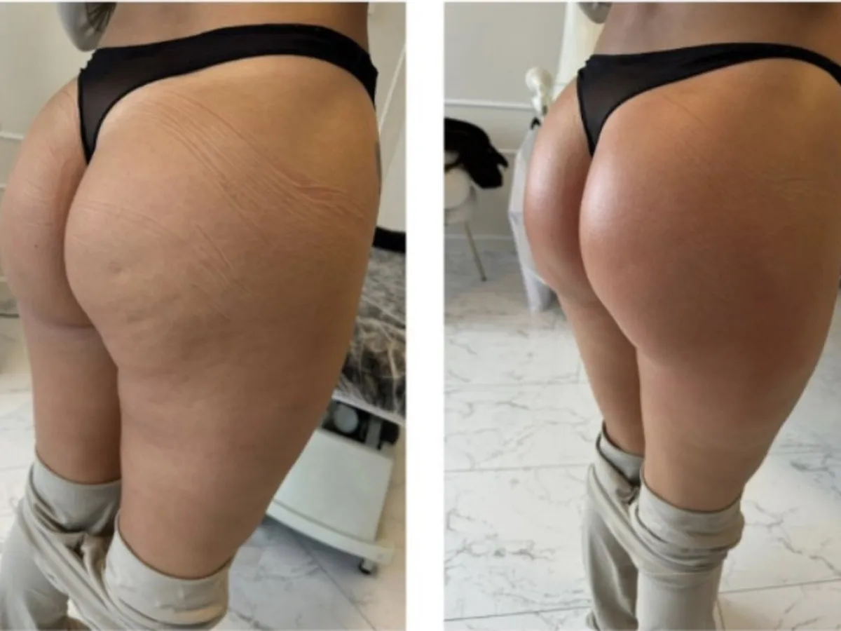 Before and after, treatment results, image 1 of 6