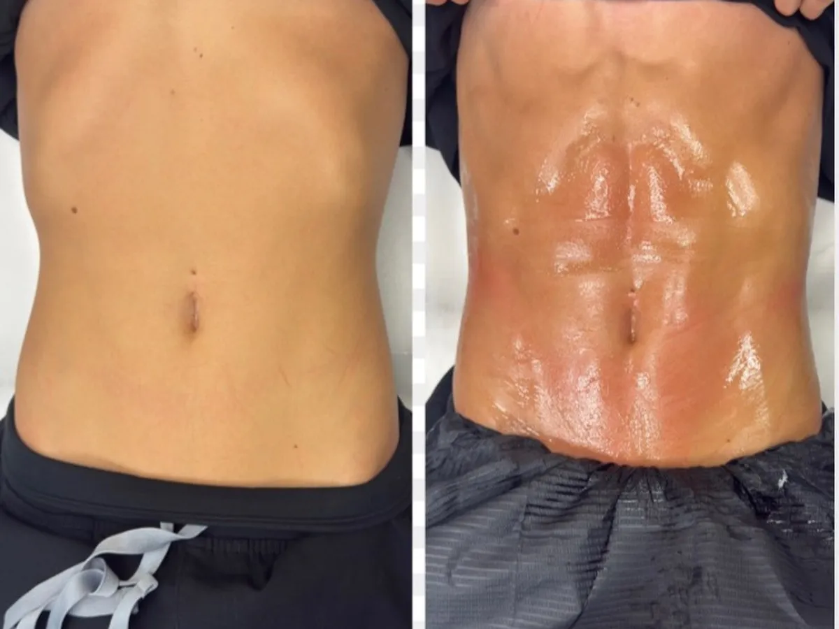 Before and after, treatment results, image 3 of 6