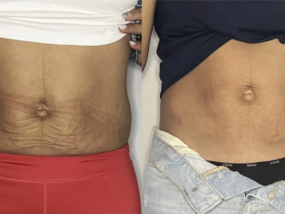 Before and after, treatment results, image 6 of 6