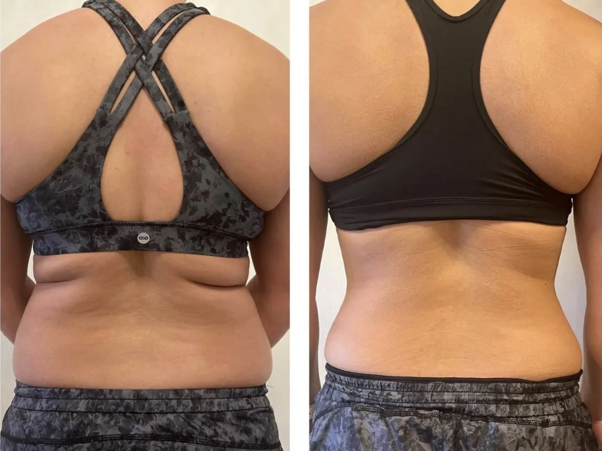 Before and after, treatment results, image 2 of 6